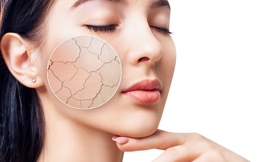 Dryness Vs. Dehydration: Understand Your Skin