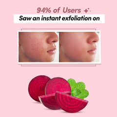 Prolixr Deep Exfoliation Foaming Face Wash with AHA BHA & Beetroot | Minimize Pigmentation | Clarifies Pores | Suitable for All Skin Types - 80ml